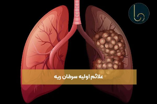علائم اولیه سرطان ریه