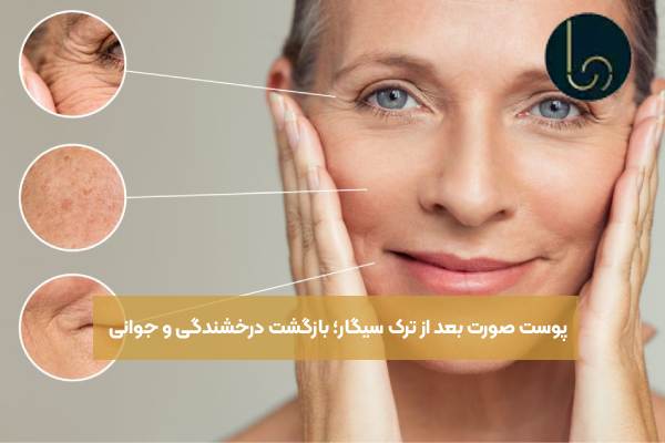 پوست صورت بعد از ترک سیگار؛ بازگشت درخشندگی و جوانی