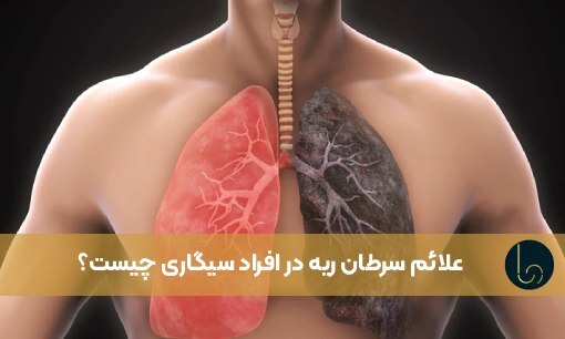 علائم سرطان ریه در افراد سیگاری چیست؟