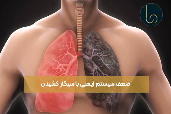 ضعف سیستم ایمنی با سیگار کشیدن