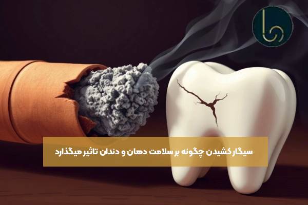 سیگار کشیدن چگونه بر سلامت دهان و دندان تاثیر میگذارد