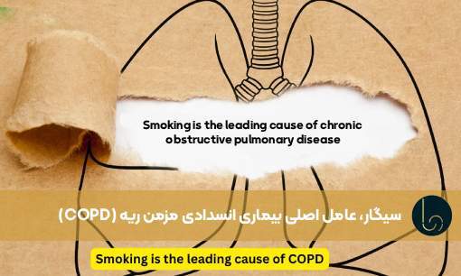 سیگار، عامل اصلی بیماری انسدادی مزمن ریه (COPD)