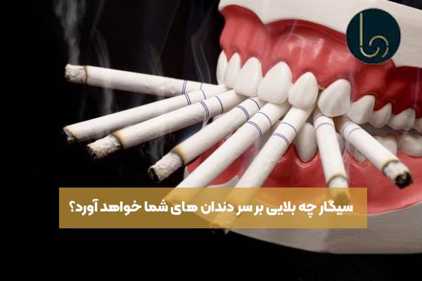 سیگار چه بلایی بر سر دندان های شما خواهد آورد؟