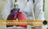برنامه فشرده ترک سیگار در زمان غربالگری سرطان ریه چه تأثیری دارد؟