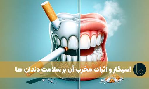 سیگار و اثرات مخرب آن بر سلامت دندان ها!