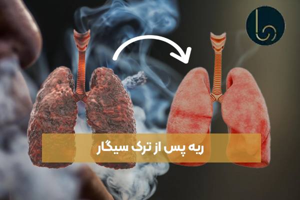 ریه پس از ترک سیگار
