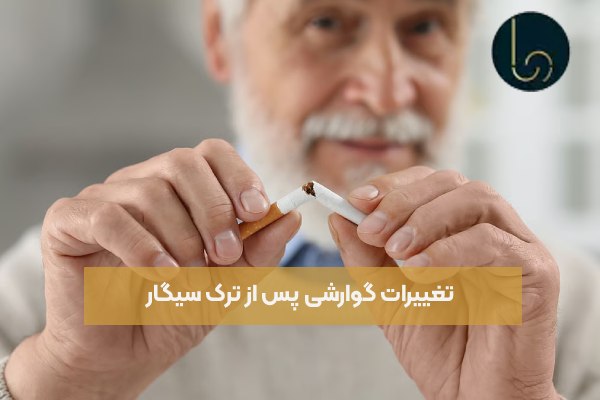تغییرات گوارشی پس از ترک سیگار